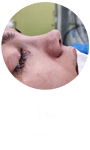 تصویر آیکون عمل زیبایی