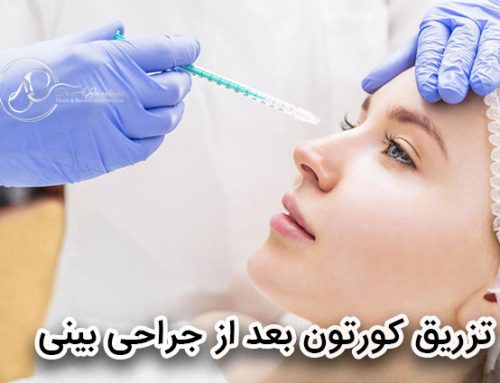 دلایل و عوارض تزریق کورتون به بینی بعد از عمل