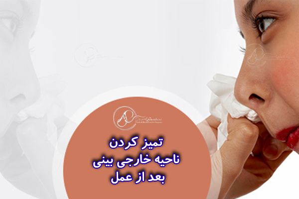 شستشوی بینی بعد از عمل