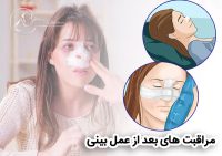 مراقبت های بعد از عمل بینی - دکتر جاودانی