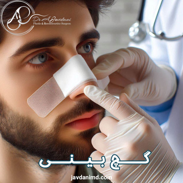 برداشتن گچ بینی - دکتر علی جاودانی 