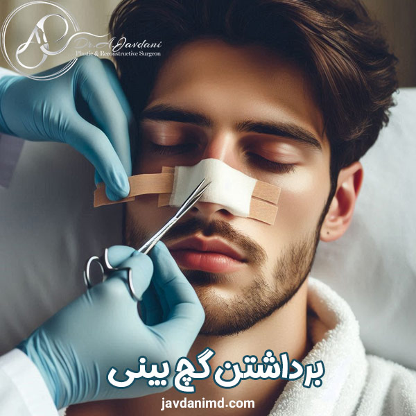 برداشتن گچ بینی - دکتر علی جاودانی