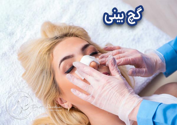 گچ بینی - دکتر جاودانی