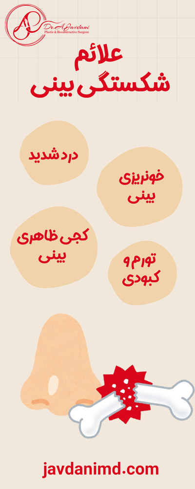 علائم شکستگی بینی - دکتر علی جاودانی