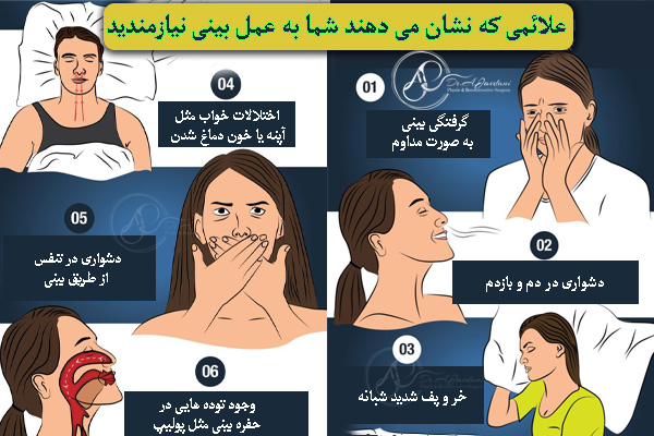جراحی بینی