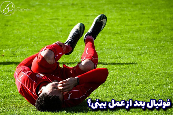 ورزش بعد از عمل بینی