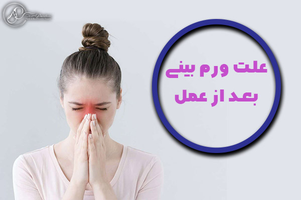 جراحی بینی - دکتر جاودانی