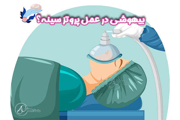 پروتز سینه - دکتر علی جاودانی