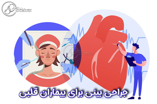 جراحی بینی در تهران - دکتر جاودانی