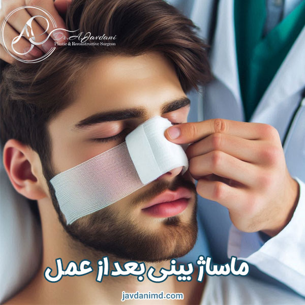 ماساژ بینی بعد از عمل - دکتر علی جاودانی