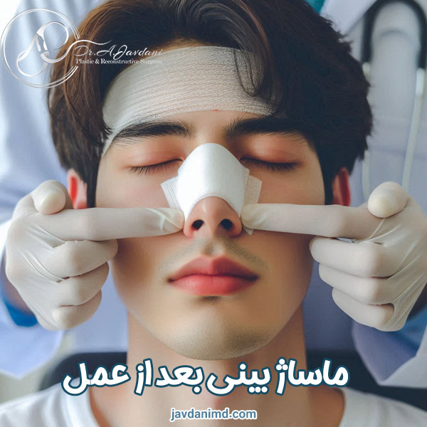 ماساژ بینی بعد از عمل - دکتر علی جاودانی