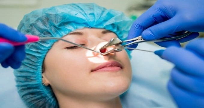جراحی بینی چه عوارضی دارد ؟