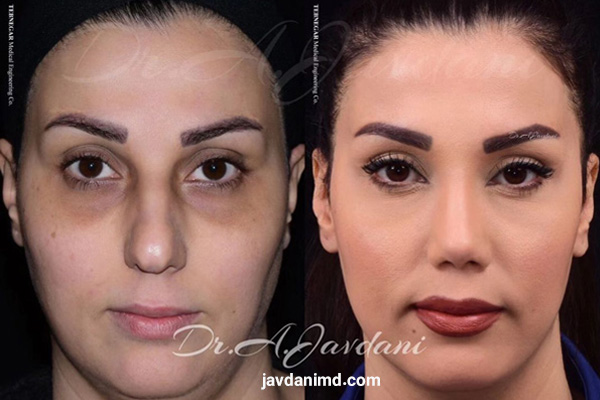 جراح بینی تهران - دکتر علی جاودانی