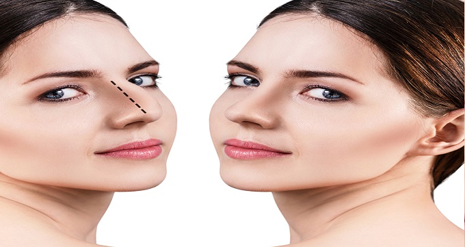 تاثیر ضخامت پوست در جراحی بینی 