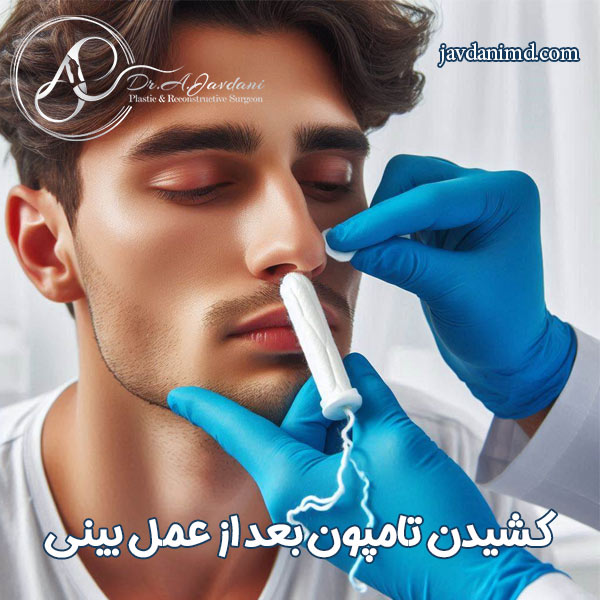 تامپون بینی - دکتر علی جاودانی