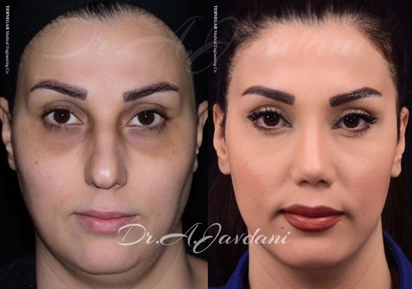 جراح بینی تهران - دکتر علی جاودانی