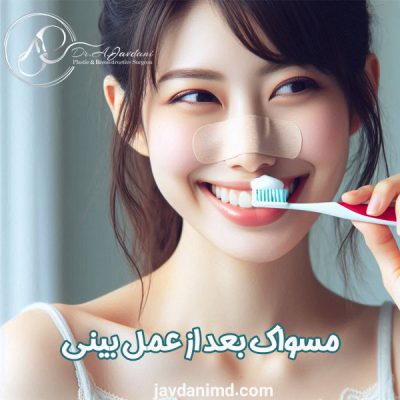 مسواک بعد از عمل بینی - دکتر علی جاودانی