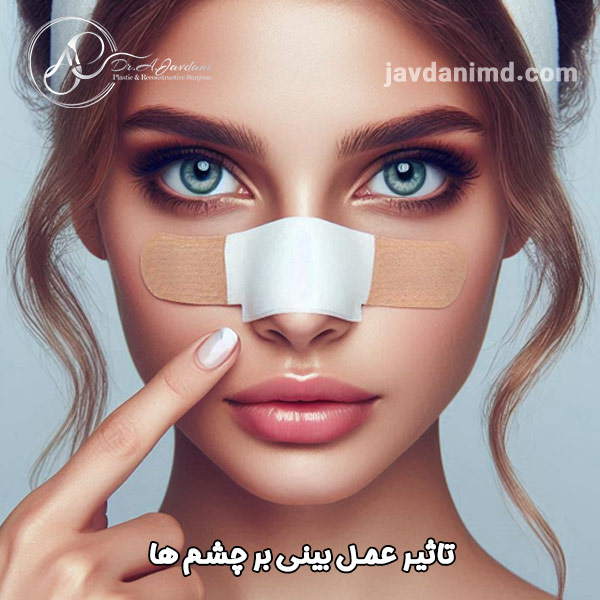 تاثیر عمل بینی بر چشم ها - دکتر علی جاودانی
