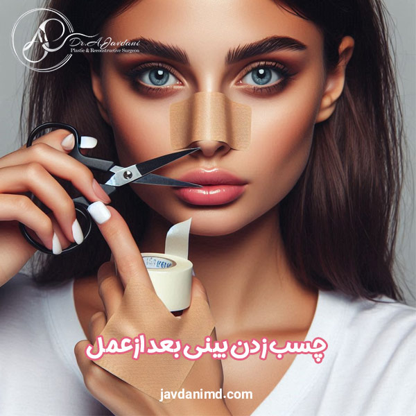 چسب زدن بینی بعد از عمل - دکتر جاودانی