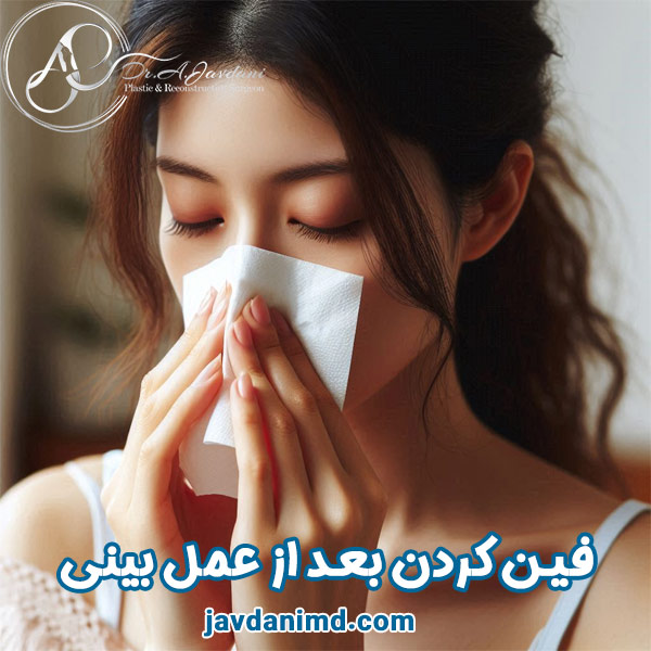 فین کردن بعد از عمل بینی - دکتر علی جاودانی
