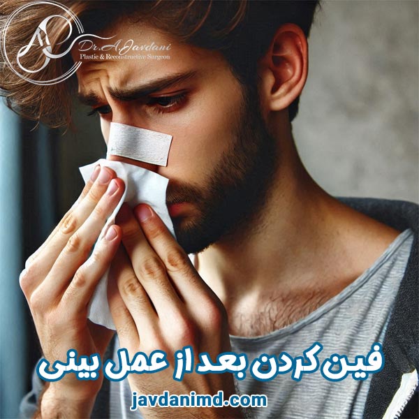 فین کردن بعد از عمل بینی - دکتر علی جاودانی