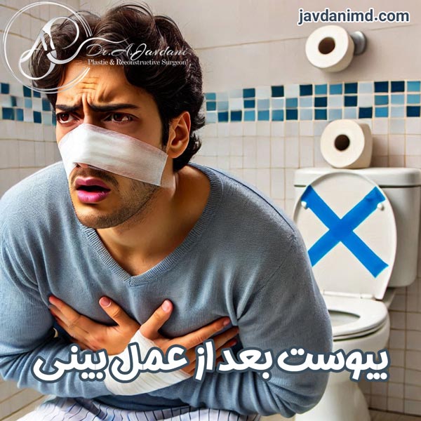 یبوست بعد از عمل بینی - دکتر جاودانی