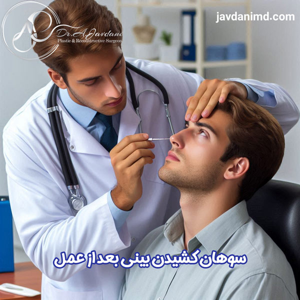 سوهان کشیدن بینی بعد از عمل - دکتر علی جاودانی