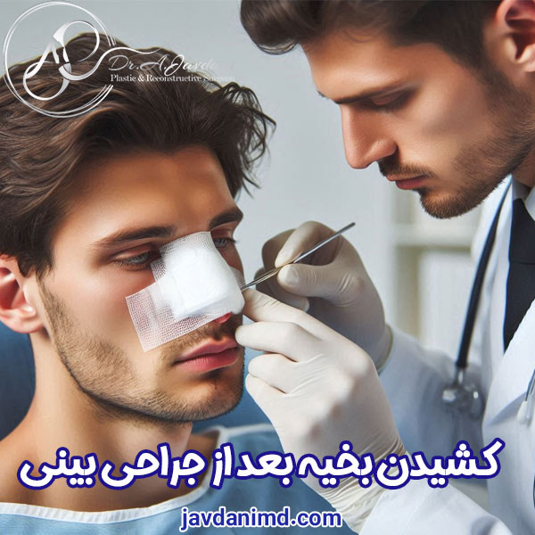 کشیدن بخیه بعد از جراحی بینی - دکتر علی جاودانی
