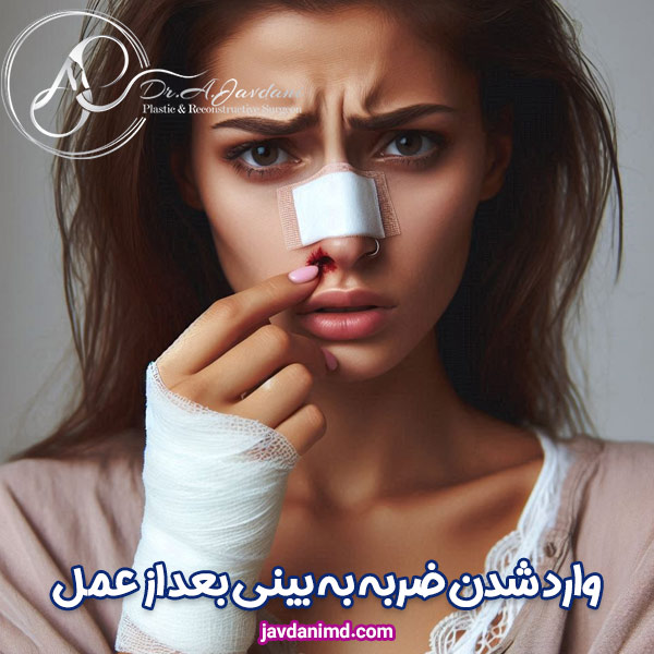 وارد شدن ضربه به بینی بعد از عمل - دکتر علی جاودانی