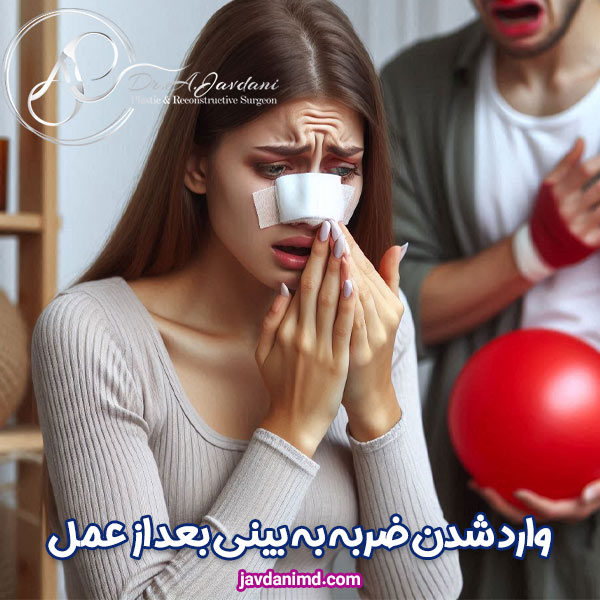 وارد شدن ضربه به بینی بعد از عمل - دکتر علی جاودانی