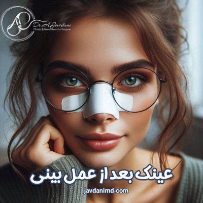 عینک بعد از عمل بینی - دکتر جاودانی