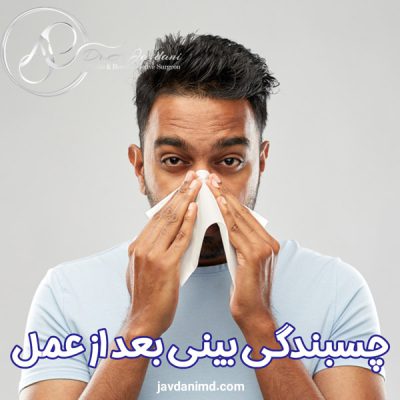 چسبندگی بینی بعد از عمل - دکتر جاودانی