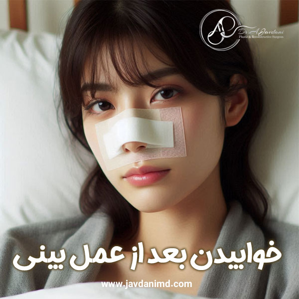 خوابیدن بعد از عمل بینی + دکتر علی جاودانی
