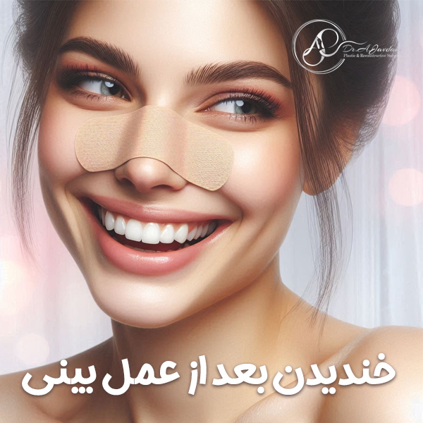 خندیدن بعد از عمل بینی + دکتر علی جاودانی