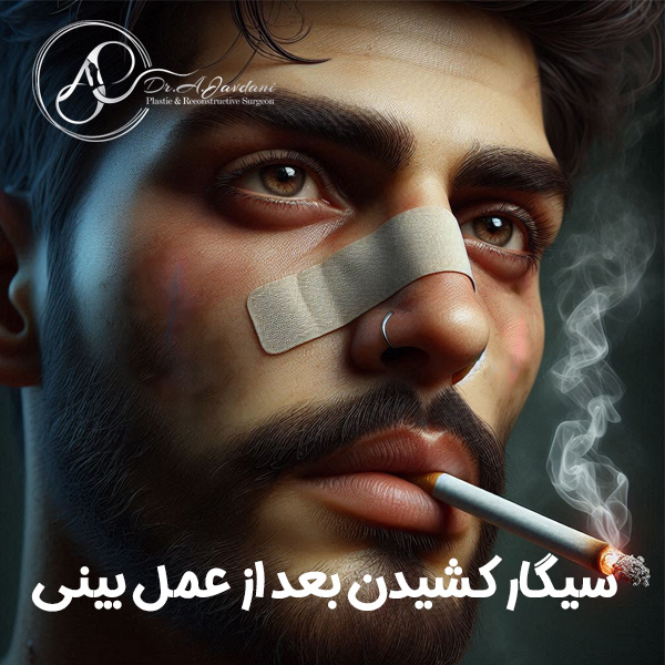 سیگار کشیدن بعد از عمل بینی + دکتر علی جاودانی