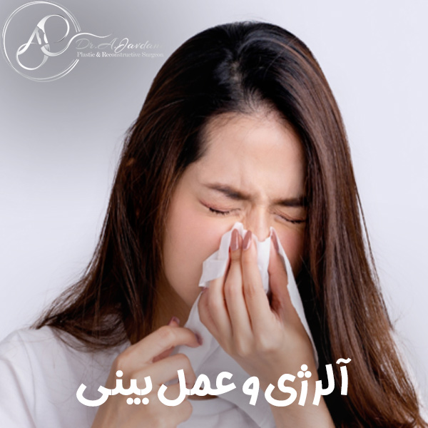 آلرژی و عمل بینی + دکتر علی جاودانی