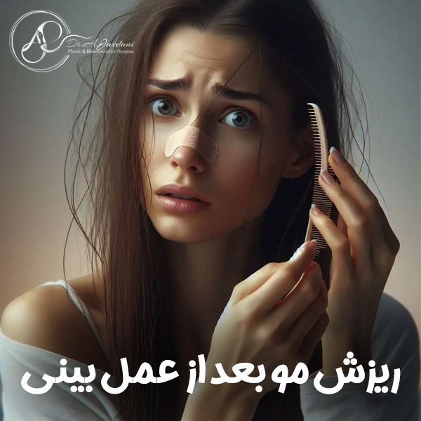 ریزش مو بعد از عمل بینی + دکتر علی جاودانی