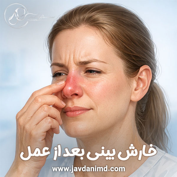 خارش بینی بعد از عمل + دکتر علی جاودانی