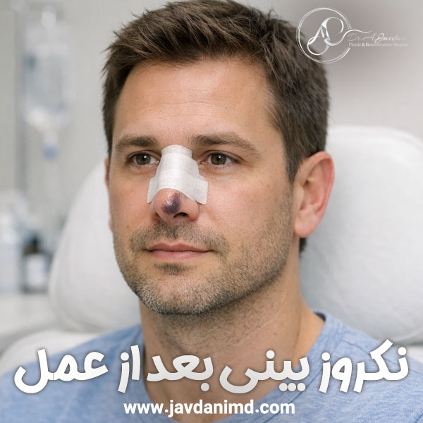 نکروز بینی بعد از عمل بینی + دکتر علی جاودانی