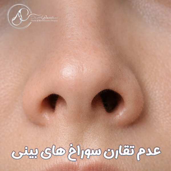 عدم تقارن سوراخ های بینی + دکتر علی جاودانی