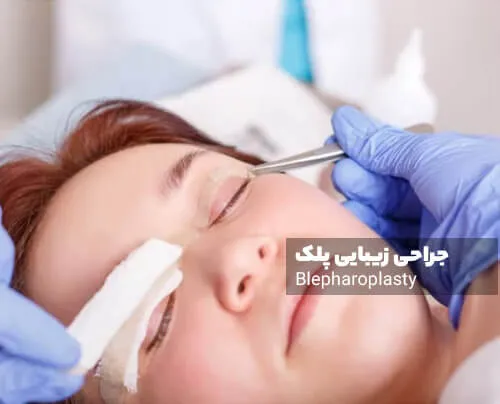 تصویر جراحی زیبایی پلک
