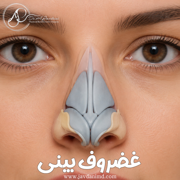 غضروف بینی + دکتر علی جاودانی