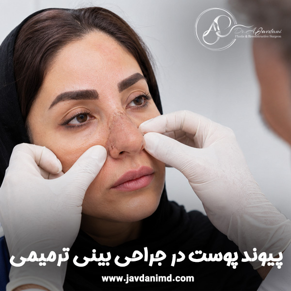 پیوند پوست در جراحی بینی ترمیمی + دکتر علی جاودانی