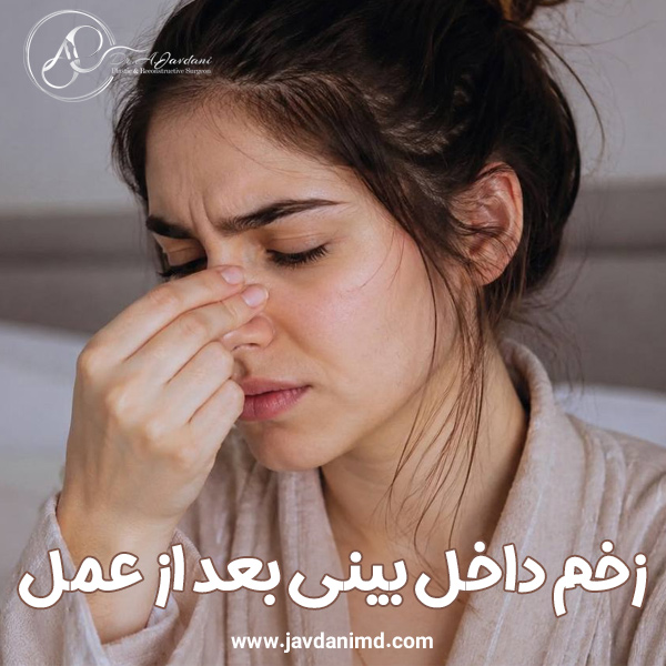 زخم داخل بینی بعد از عمل + دکتر علی جاودانی